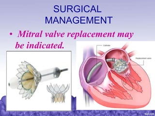 SURGICAL
MANAGEMENT
• Mitral valve replacement may
be indicated.
 