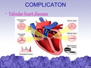 COMPLICATON
• Valvular heart diseases
 