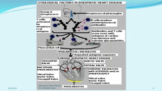 Rhd Crieteira Rheumatic Heart Disease | PDF