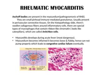 Rhd Swelling Rheumatic_Heart_Disease by Ananya Singha | PPTX