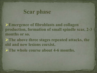 Scar phase
Emergence of fibroblasts and collagen
production, formation of small spindle scar, 2-3
months or so.
The above three stages repeated attacks, the
old and new lesions coexist.
The whole course about 4-6 months.
 