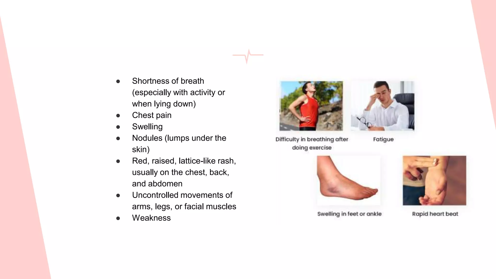 Heart Problems Leg Rash Rheumatic heart diseases | PPTX | Heart and Cardiovascular Diseases ...