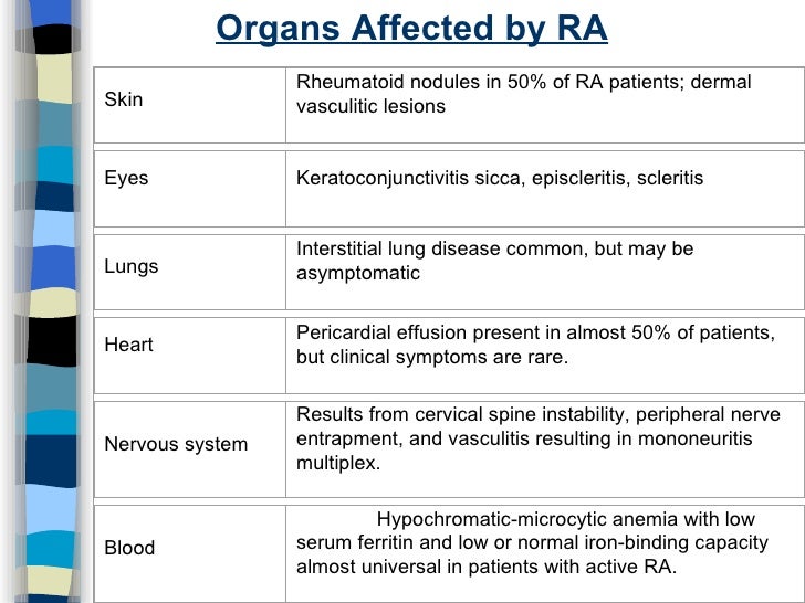 Rheumatoid Arthritis