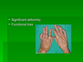 The Hand therapist's role: Rheumatoid Thumb - Splinting/Rehabilitation ...