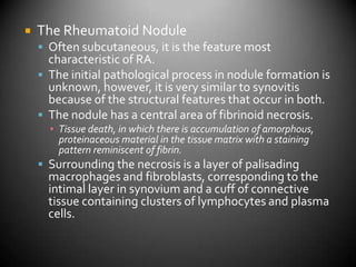 The Rheumatoid NoduleOften subcutaneous, it is the feature most characteristic of RA.  The initial pathological process in nodule formation is unknown, however, it is very similar to synovitis because of the structural features that occur in both.The nodule has a central area of fibrinoid necrosis.Tissue death, in which there is accumulation of amorphous, proteinaceous material in the tissue matrix with a staining pattern reminiscent of fibrin.Surrounding the necrosis is a layer of palisading macrophages and fibroblasts, corresponding to the intimal layer in synovium and a cuff of connective tissue containing clusters of lymphocytes and plasma cells.