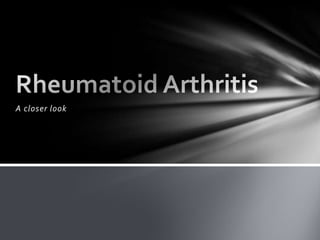 A closer look Rheumatoid Arthritis 