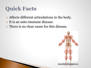  Affects different articulations in the body. 
 It is an auto-immune disease. 
 There is no clear cause for this disease. 
noeydali.blogspot.es 
 