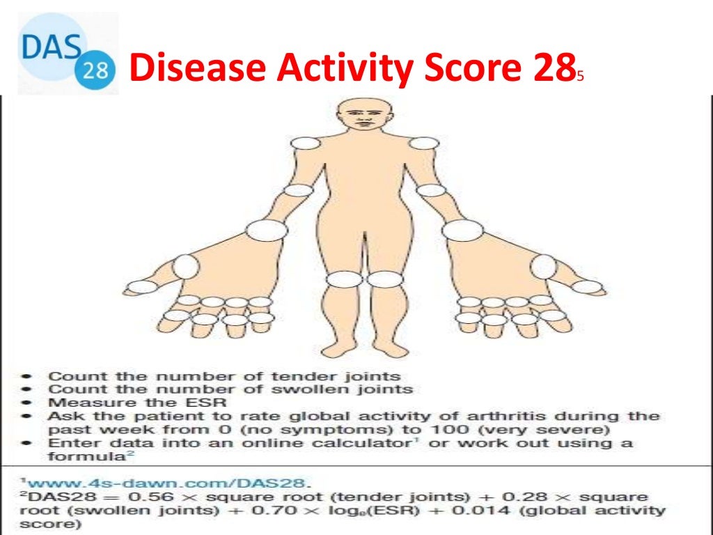 Rheumatoid arthritis