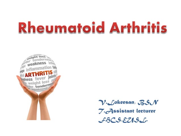 Understanding Rheumatoid Arthritis: Causes, Symptoms and Treatment | PPT