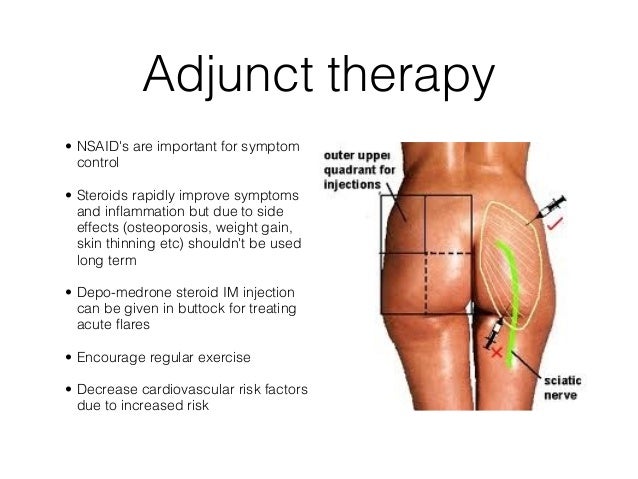 Side effects of steroids for arthritis