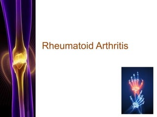 Rheumatoid Arthritis
 