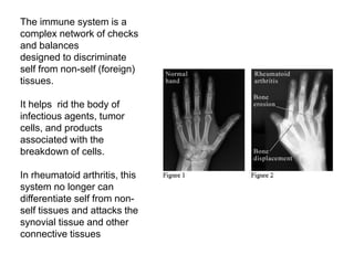 The immune system is a
complex network of checks
and balances
designed to discriminate
self from non-self (foreign)
tissues.
It helps rid the body of
infectious agents, tumor
cells, and products
associated with the
breakdown of cells.
In rheumatoid arthritis, this
system no longer can
differentiate self from non-
self tissues and attacks the
synovial tissue and other
connective tissues
 
