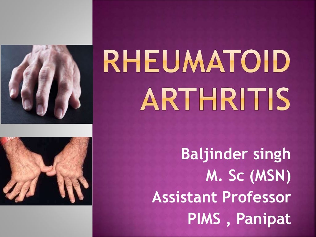 Rheumatoid arthritis