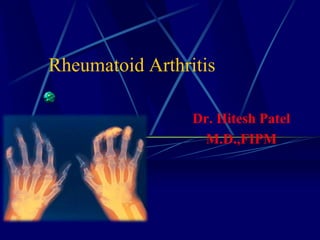 Rheumatoid Arthritis
Dr. Hitesh Patel
M.D.,FIPM
 