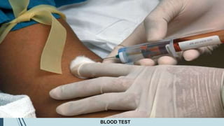 Rheumatoid arthritis | PPTX