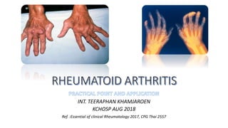 INT. TEERAPHAN KHAMJAROEN
KCHOSP AUG 2018
Ref. :Essential of clinical Rheumatology 2017, CPG Thai 2557
 