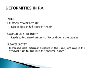 KNEE
1.FLEXION CONTRACTURE
 Due to loss of full knee extension
2.QUADRICEPS ATROPHY
 Leads to increased amount of force though the patella
3.BAKER’S CYST
 Increased intra-articular pressure in the knee joint causes the
synovial fluid to drip into the popliteal space
 