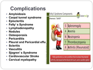 Complications
 Amyloidosis
 Carpal tunnel syndrome
 Episcleritis
 Felty’ s Syndrome
 Lymphadenopathy
 Nodules
 Osteoporosis
 Pericarditis
 Pleural and Pericardial effusion
 Scleritis
 Vasculitis
 Sjogren’ s Syndrome
 Cardiovascular Stroke
 Cervical myelopathy
 