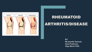 RHEUMATOID
ARTHRITIS/DISEASE
BY:
Ms.Keerthi Samuel,
Asst.Professor,
Vijay Marie CON
 