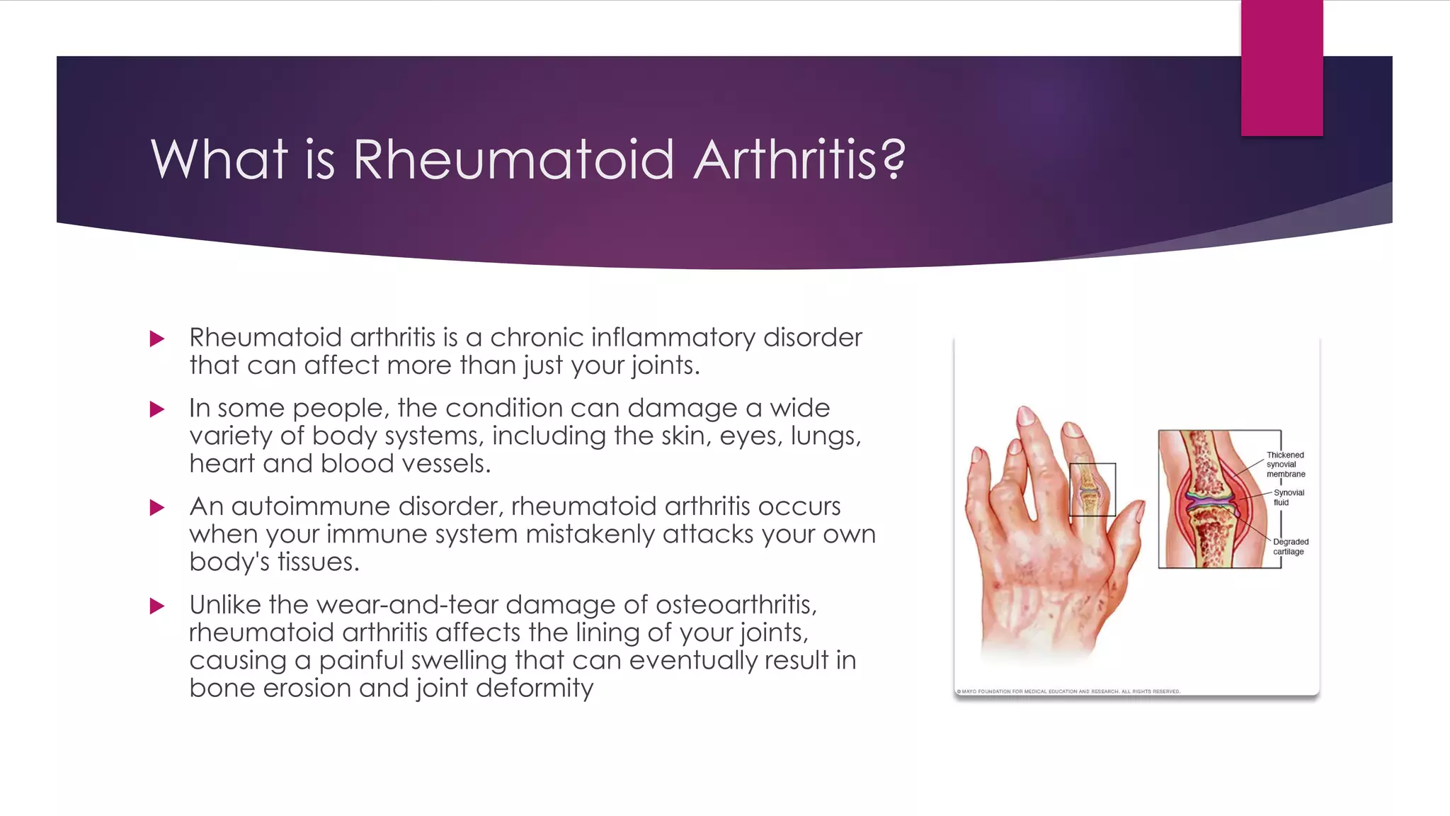 Rheumatoid arthritis- diagnosis and treatment | PDF