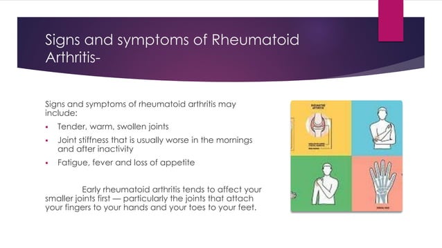 ARTHRITIS DIAGNOSIS AND TREATMENT visual data 8