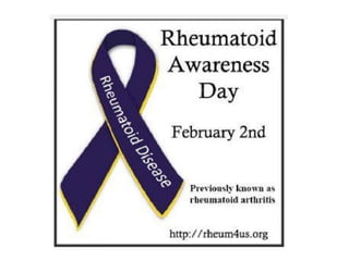 Rheumatoid Arthritis.pptx
