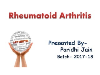 Presented By-
Paridhi Jain
Batch- 2017-18
 
