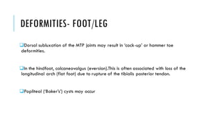 DEFORMITIES- FOOT/LEG
❑Dorsal subluxation of the MTP joints may result in ‘cock-up’ or hammer toe
deformities.
❑In the hindfoot, calcaneovalgus (eversion).This is often associated with loss of the
longitudinal arch (flat foot) due to rupture of the tibialis posterior tendon.
❑Popliteal (‘Baker’s’) cysts may occur
 