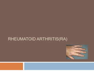 RHEUMATOID ARTHRITIS(RA)
 