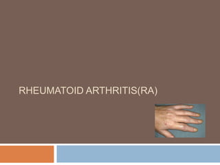 Rheumatoid arthritis.ppt