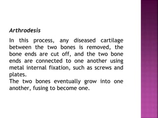 Arthrodesis
In this process, any diseased cartilage
between the two bones is removed, the
bone ends are cut off, and the two bone
ends are connected to one another using
metal internal fixation, such as screws and
plates.
The two bones eventually grow into one
another, fusing to become one.
 