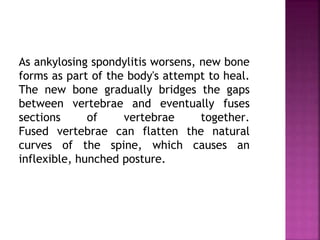 As ankylosing spondylitis worsens, new bone
forms as part of the body's attempt to heal.
The new bone gradually bridges the gaps
between vertebrae and eventually fuses
sections of vertebrae together.
Fused vertebrae can flatten the natural
curves of the spine, which causes an
inflexible, hunched posture.
 