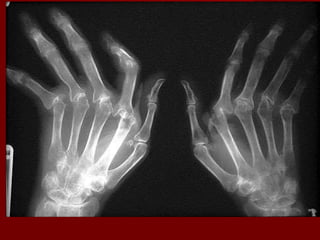 0
10
20
30
40
50
60
70
80
90
1st Qtr 2nd Qtr 3rd Qtr 4th Qtr
East
West
North
 