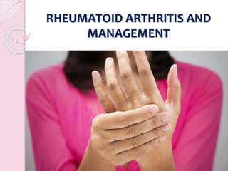 RHEUMATOID ARTHRITIS AND
MANAGEMENT
 