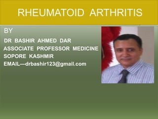       RHEUMATOID  ARTHRITIS<br /> BY<br />DR  BASHIR  AHMED  DAR <br />ASSOCIATE  PROFESSOR  MEDICINE<br /> SOPORE  KASHMI...