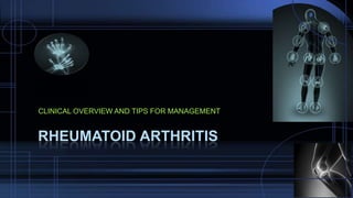 CLINICAL OVERVIEW AND TIPS FOR MANAGEMENT
RHEUMATOID ARTHRITIS
 