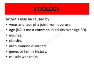ETIOLOGY
Arthritis may be caused by :
• wear and tear of a joint from overuse.
• age (RA is most common in adults over age 50)
• injuries.
• obesity.
• autoimmune disorders.
• genes or family history.
• muscle weakness.
 