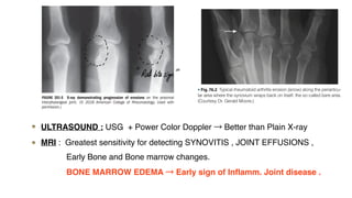 Kelly Rheumatology Rheumatoid arthritis ppt ( Ref : Harrisons principles of Internal ...