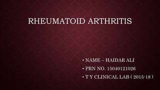RHEUMATOID ARTHRITIS
• NAME – HAIDAR ALI
• PRN NO. 15040121026
• T Y CLINICAL LAB ( 2015-18 )
 