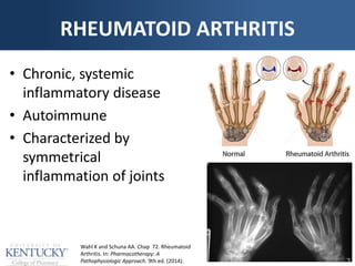 RHEUMATOID ARTHRITIS
• Chronic, systemic
inflammatory disease
• Autoimmune
• Characterized by
symmetrical
inflammation of joints
Wahl K and Schuna AA. Chap 72. Rheumatoid
Arthritis. In: Pharmacotherapy: A
Pathophysiologic Approach. 9th ed. (2014).
 