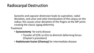 Radiocarpal Destruction
Synovitis and capsular distension leads to supination, radial
deviation, and ulnar and volar translocation of the carpus on the
radius; this causes ulnar deviation of the fingers at the MP joints
creating the classic zigzag deformity
Treatment
• Synovectomy for early disease
• Transfer of ECRL to ECU to diminish deforming forces
(Clayton's procedure)
• Radiolunate fusion (Chamay) for intermediate disease
 