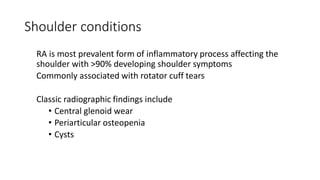 Shoulder conditions
RA is most prevalent form of inflammatory process affecting the
shoulder with >90% developing shoulder symptoms
Commonly associated with rotator cuff tears
Classic radiographic findings include
• Central glenoid wear
• Periarticular osteopenia
• Cysts
 