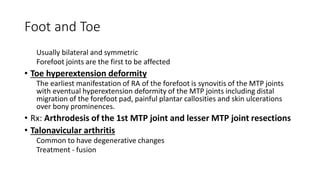 Foot and Toe
Usually bilateral and symmetric
Forefoot joints are the first to be affected
• Toe hyperextension deformity
The earliest manifestation of RA of the forefoot is synovitis of the MTP joints
with eventual hyperextension deformity of the MTP joints including distal
migration of the forefoot pad, painful plantar callosities and skin ulcerations
over bony prominences.
• Rx: Arthrodesis of the 1st MTP joint and lesser MTP joint resections
• Talonavicular arthritis
Common to have degenerative changes
Treatment - fusion
 