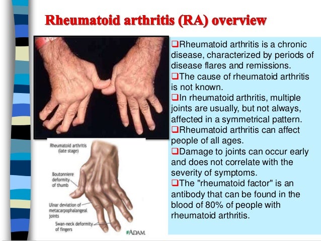 Rheumtoid arthritis