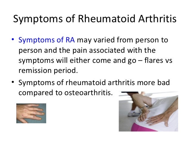 Juvenile Rheumatoid Arthritis 4 Juvenile Rheumatoid Arthritis 4