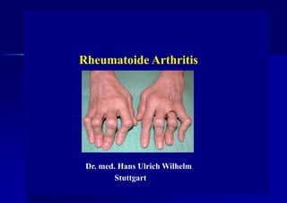 Rheumatoide Arthritis
Dr. med. Hans Ulrich Wilhelm
Stuttgart
 