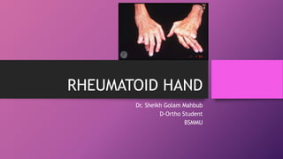 RHEUMATOID HAND
Dr. Sheikh Golam Mahbub
D-Ortho Student
BSMMU
 