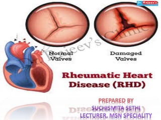 Rheumatoid heart disease | PPTX