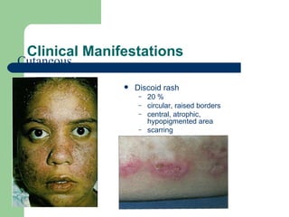 Rheumatology | PPT