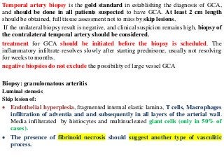 Temporal artery biopsy is the gold standard in establishing the diagnosis of GCA,
and should be done in all patients suspected to have GCA. At least 2 cm length
should be obtained, full tissue assessment not to miss by skip lesions,
If the unilateral biopsy result is negative, and clinical suspicion remains high, biopsy of
the contralateral temporal artery should be considered.
treatment for GCA should be initiated before the biopsy is scheduled. The
inflammatory infiltrate resolves slowly after starting prednisone, usually not resolving
for weeks to months.
negative biopsies do not exclude the possibility of large vessel GCA
Biopsy: granulomatous arteritis
Luminal stenosis
Skip lesion of:
 Endothelial hyperplesia, fragmented internal elastic lamina, T cells, Macrophages
infiltration of adventia and and subsequently in all layers of the arterial wall.
Media infilterated by histiocytes and multinucleated giant cells (only in 50% of
cases).
 The presence of fibrinoid necrosis should suggest another type of vasculitic
process.
 